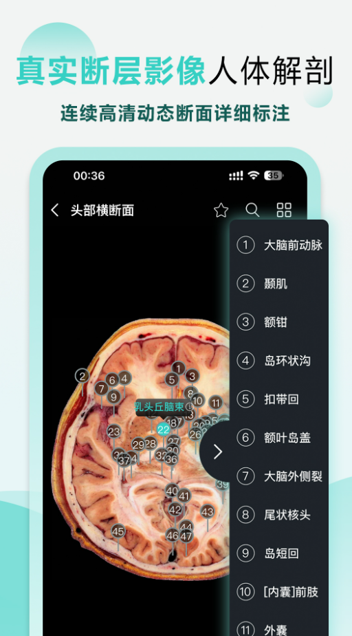 掌上3D解剖