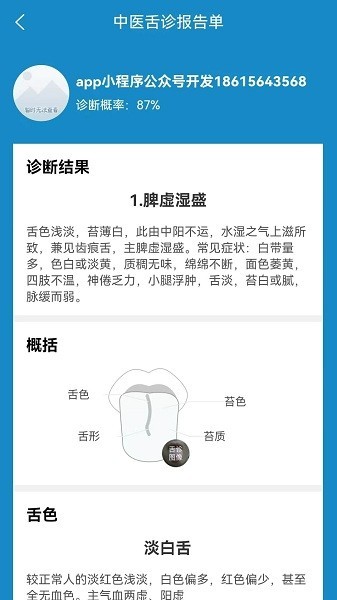 中医智能舌诊